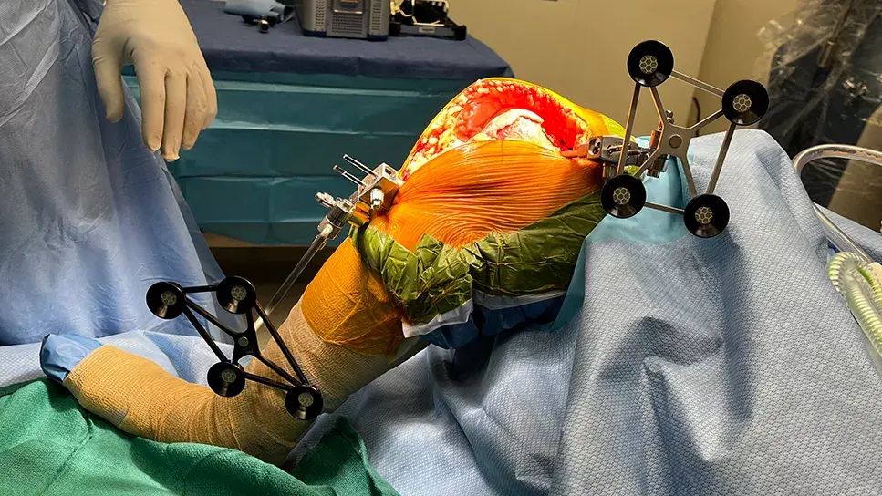 Robotic Joint Replacement