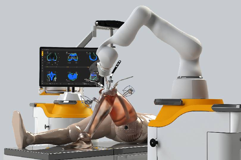 Robotic-Assisted Joint Replacement