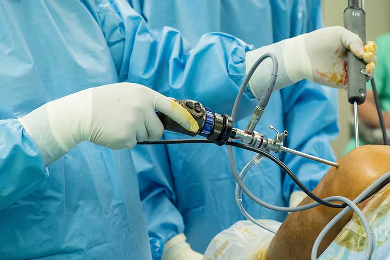 Robotic Knee Replacement