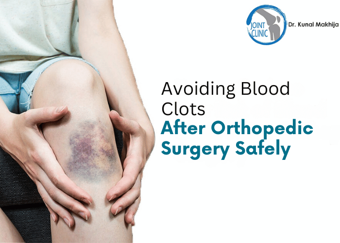 Avoiding Blood Clots After Orthopedic Surgery Safely
