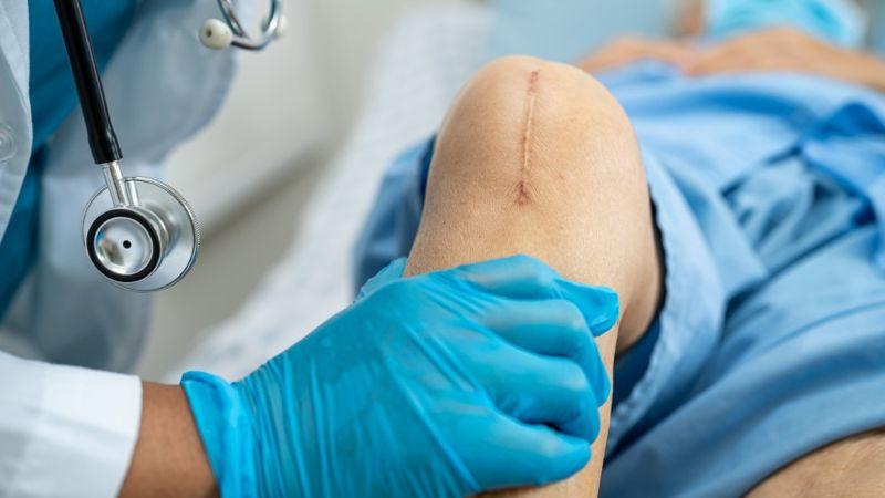 Choosing between manual and robotic knee replacement