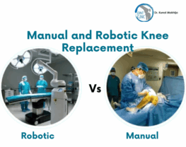 Choosing between manual and robotic knee replacement