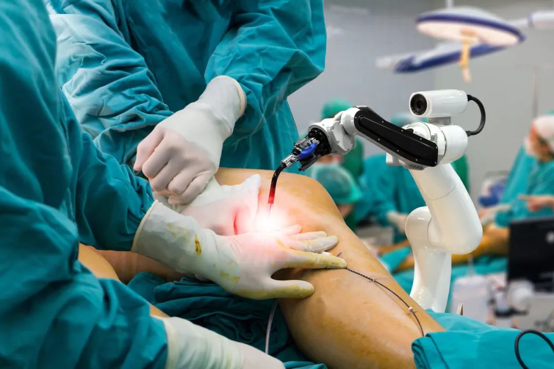 robotic-assisted knee surgeries