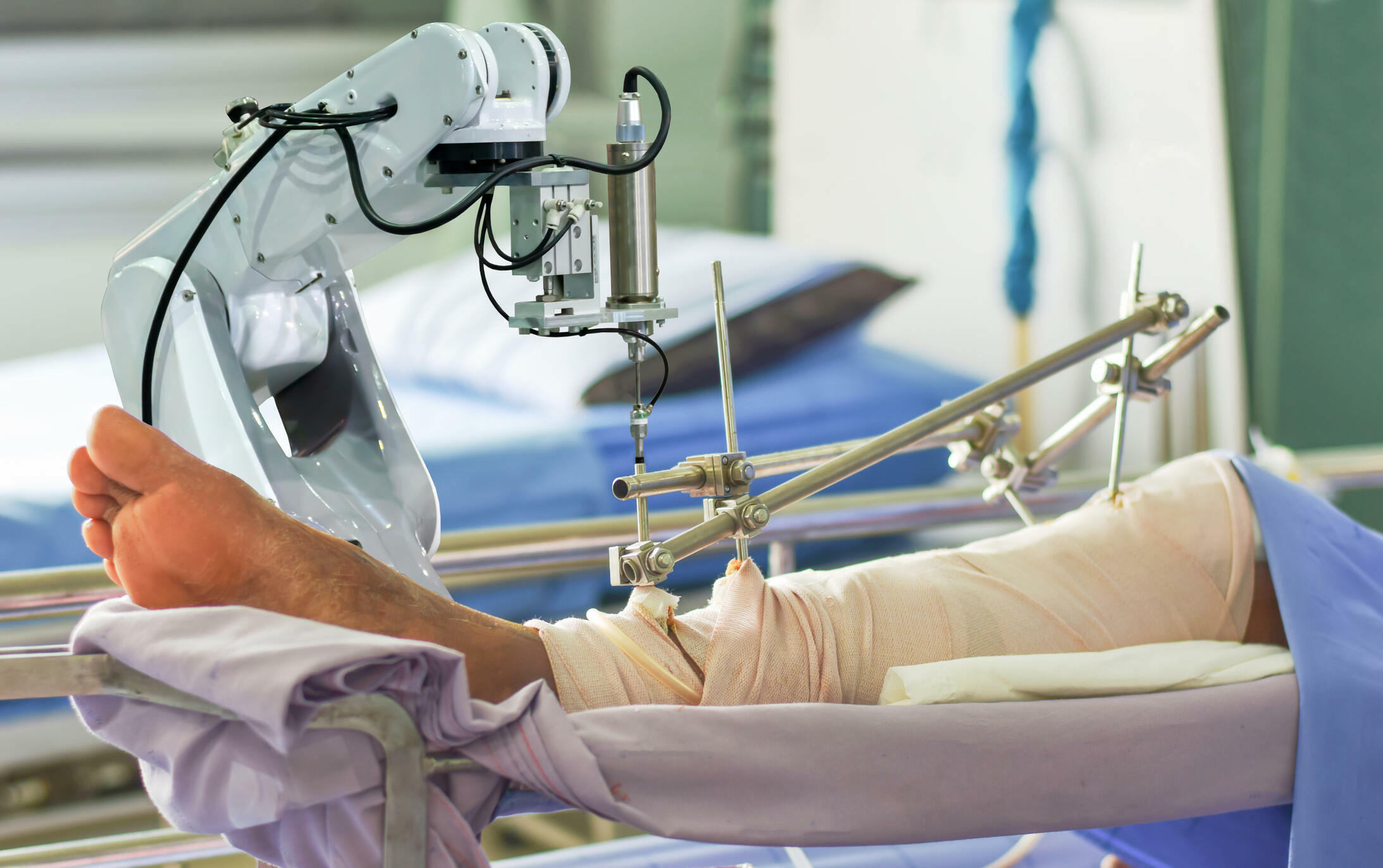 What Is Robotic Knee Replacement?